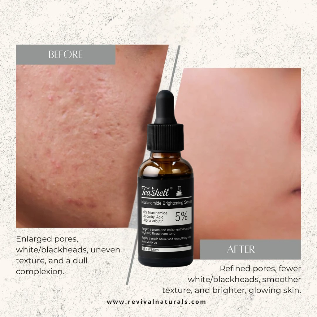 Teashell Niacinamide Brightening Serum Fades Dark Spots, Evens Skin Tone & Boosts Glow (Copy)