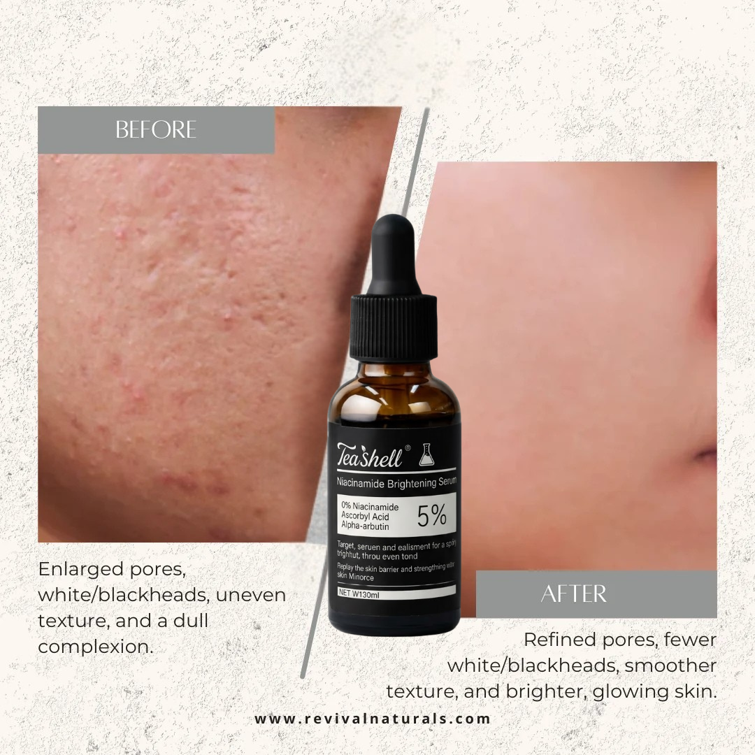 Teashell Niacinamide Brightening Serum Fades Dark Spots, Evens Skin Tone & Boosts Glow (Copy)