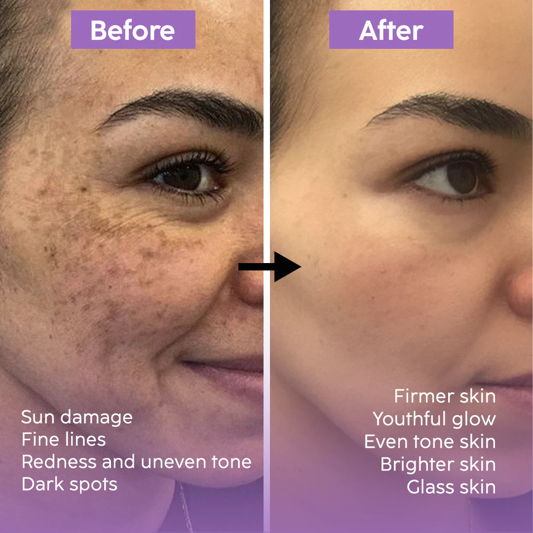 Teashell Niacinamide Brightening Serum Fades Dark Spots, Evens Skin Tone & Boosts Glow (Copy)