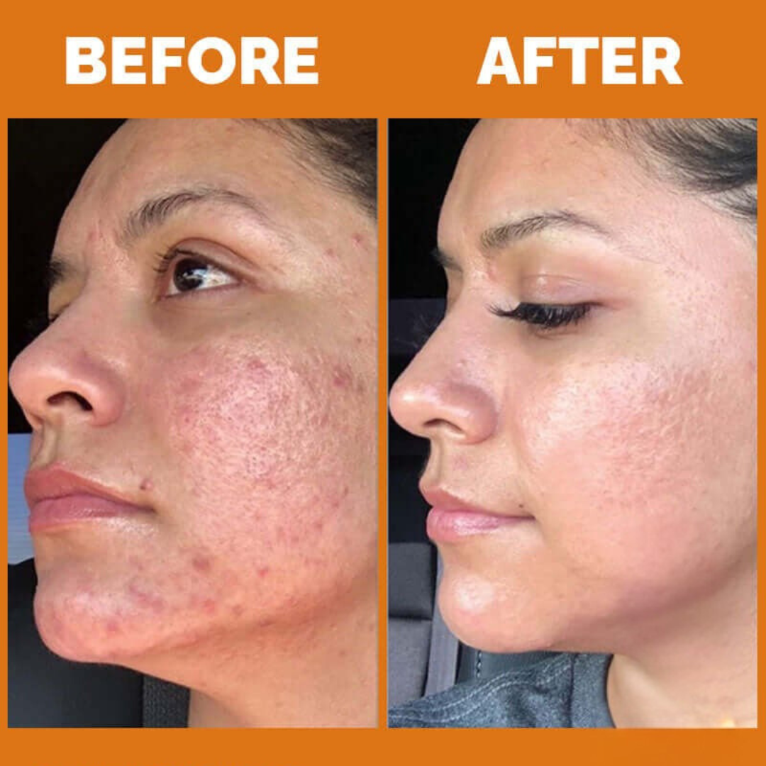 Teashell Niacinamide Brightening Serum Fades Dark Spots, Evens Skin Tone & Boosts Glow (Copy)