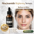 Teashell Niacinamide Brightening Serum Fades Dark Spots, Evens Skin Tone & Boosts Glow (Copy)