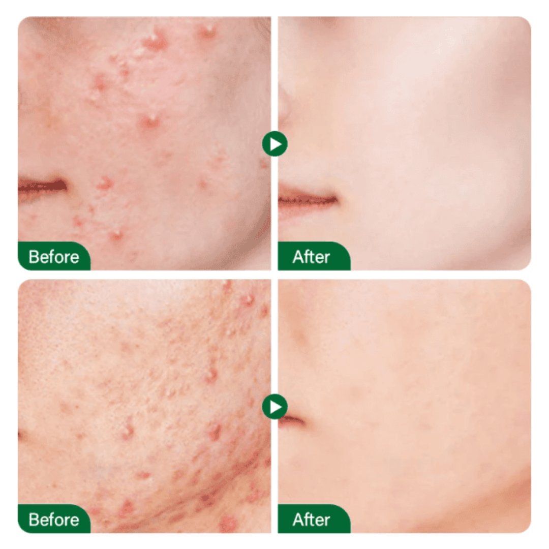 Teashell Niacinamide Brightening Serum Fades Dark Spots, Evens Skin Tone & Boosts Glow (Copy)